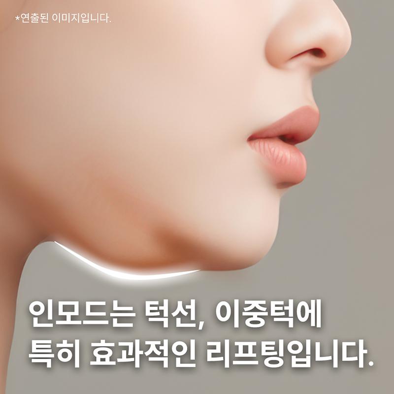 리프트성형외과의원 [대구] 인모드FX 이벤트 이미지