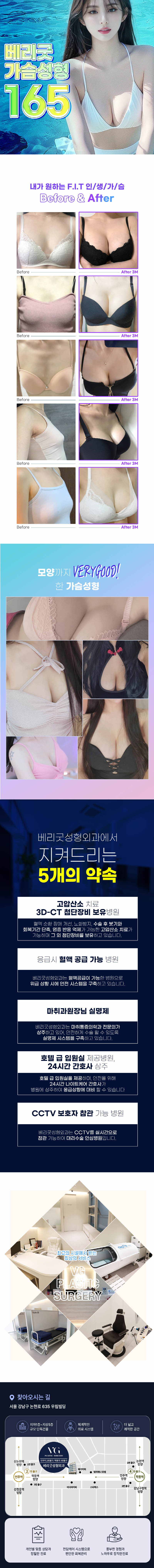 베리굿성형외과의원에서 작은 가슴, 짝가슴 등으로 고민이신 분들을 위한 베리굿 가슴성형 시술을 제공합니다.