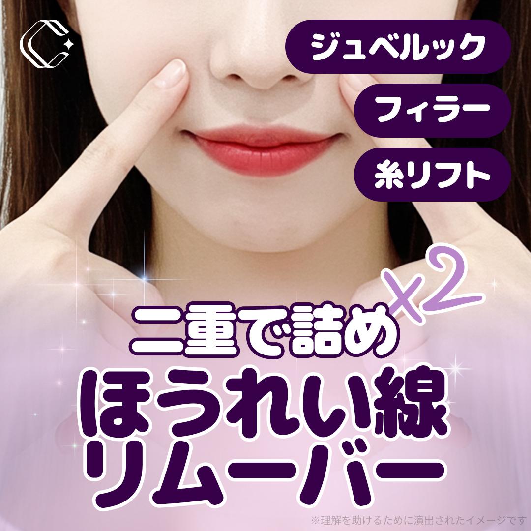 二重で詰め _ほうれい線リムーバー,ほうれい線_フィラー（ヒアルロン酸）_ジュベルック-ボリューム,ジャンバー糸_糸リフティング