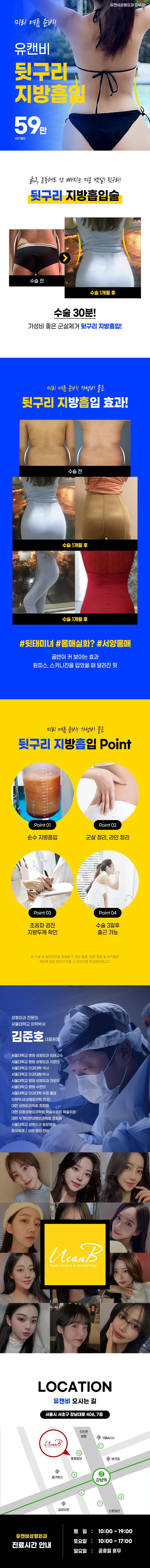 강남역 유캔비성형외과의 뒷구리 지방흡입 59만원 특가 프로모션, 수술 30분 소요의 빠른 시술