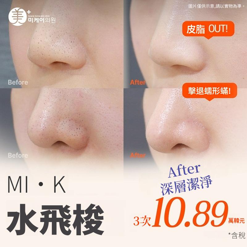 米凱 水飛梭 3次