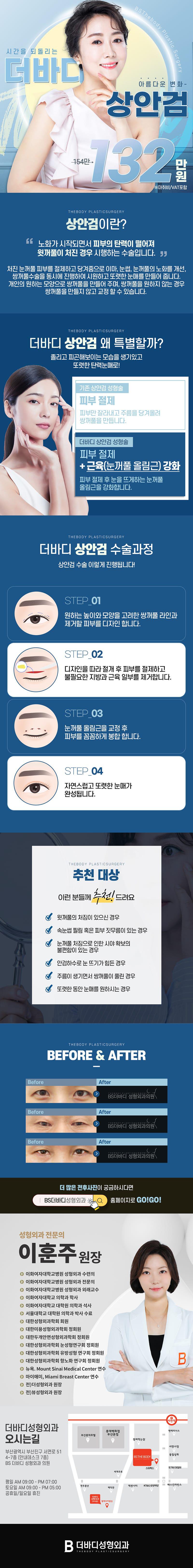 부산 서면 더바디성형외과의원에서 제공하는 더바디 상안검 성형 시술로 윗꺼풀의 처짐, 속눈썹 찔림 및 피부 짓무름 개선
