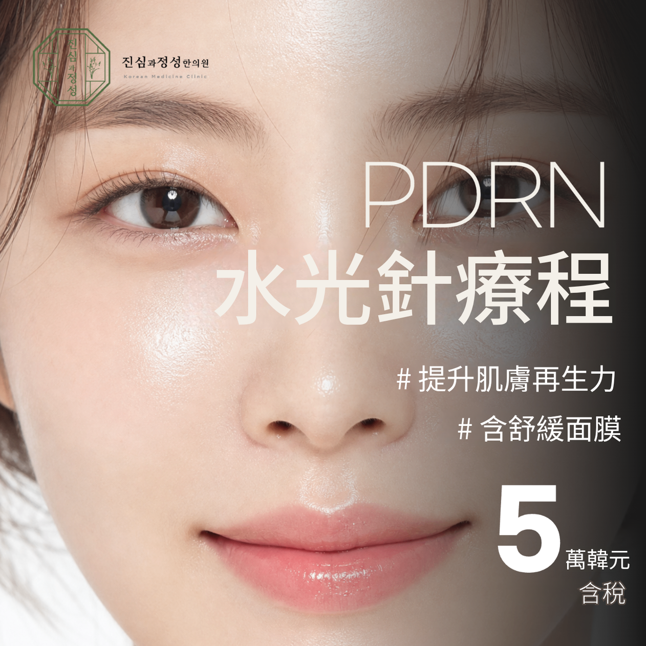 PDRN 水光針