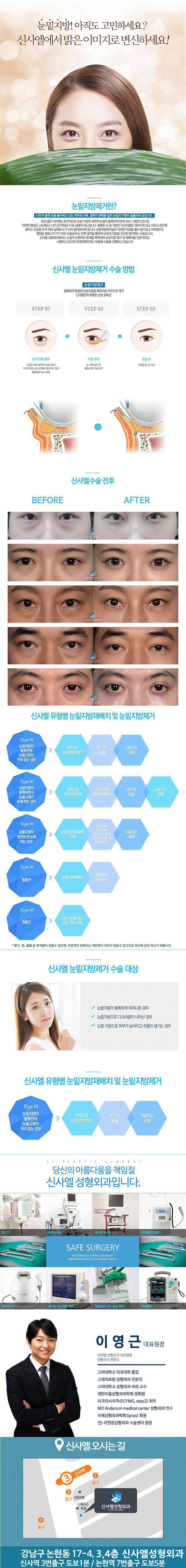 서울 신사동 소재 신사엘성형외과의 눈밑지방재배치 시술로 다크서클과 노화 고민을 해결하는 49만원 특가 프로모션