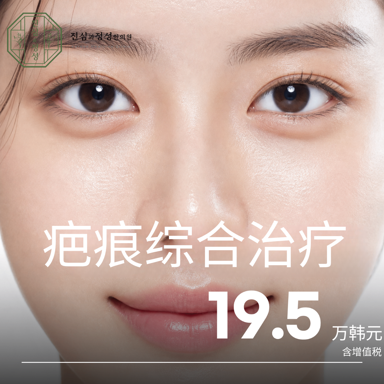 疤痕综合治疗
