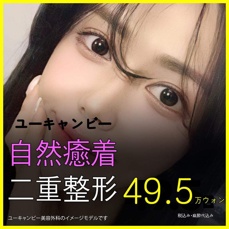ユーキャンビー自然癒着二重整形