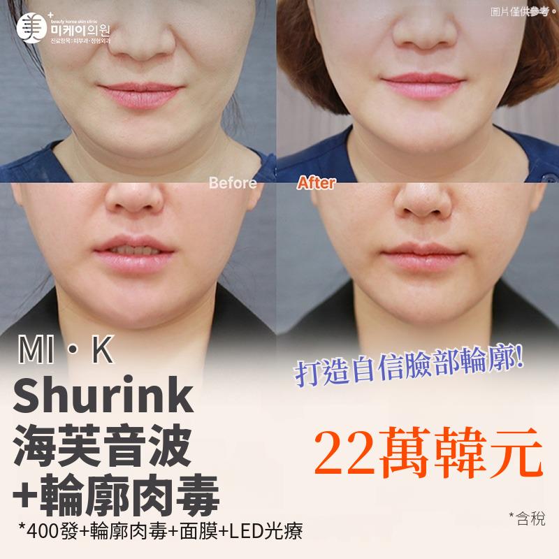 美K Shurink海芙音波・輪廓肉毒