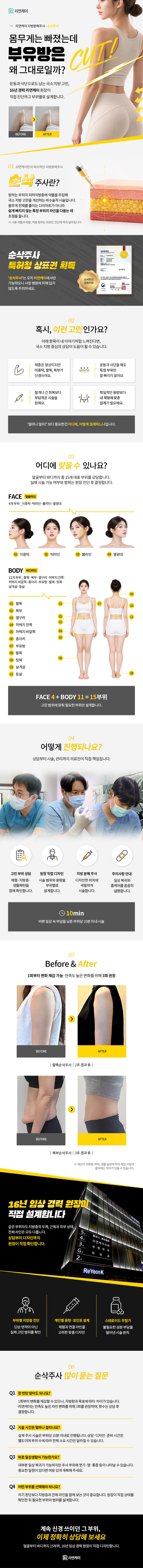 리연케이의원에서 제공하는 NO스테로이드 부유방순삭주사 서비스를 소개합니다. 서울 압구정에 위치한 리연케이의원에서 운영하는 이 서비스는 운동과 식단으로도 빠지지 않는 부유방 고민을 해결하기 위한 순삭주사입니다.