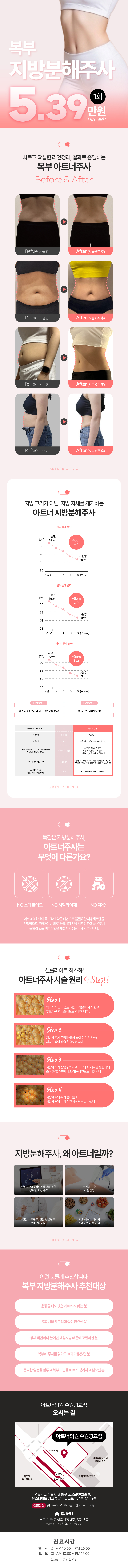 아트너의원(광교점)에서 진행하는 오픈특가 수원 뱃살확빼주사