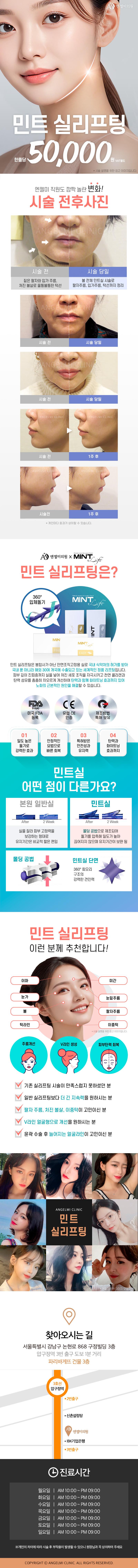 서울 압구정 엔젤미의원의 민트실리프팅 5만원 특가 프로모션으로 처진 볼살과 턱라인 개선