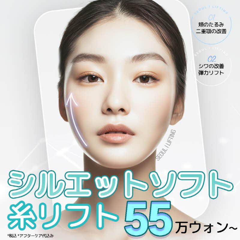 シルエットソフト糸リフト