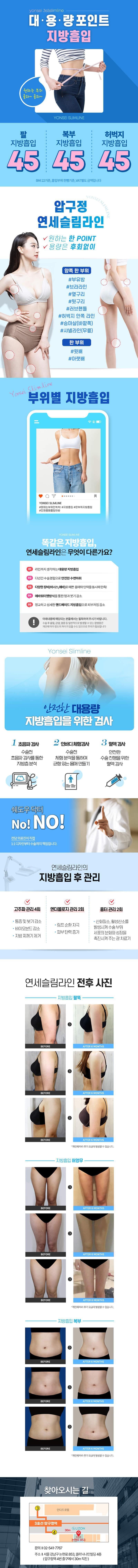 서울 압구정 리즈온위드연세슬림라인의원의 45만원 대용량 포인트 지방흡입 시술 프로모션