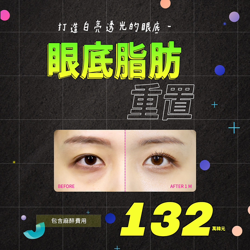 DB 眼下脂肪重置