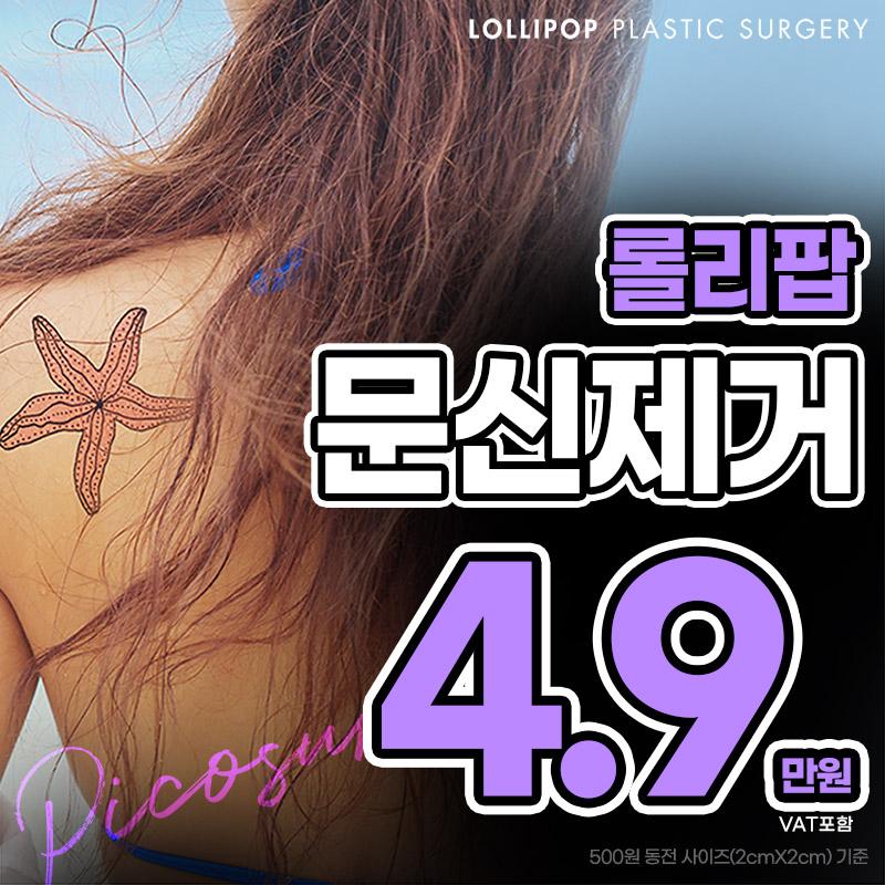 롤리팝 문신(타투)제거