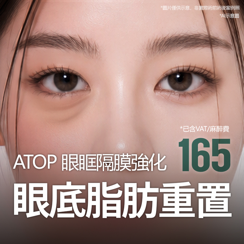 眼眶隔膜強化 保留臥蠶 眼底脂肪重置，改善黑眼圈