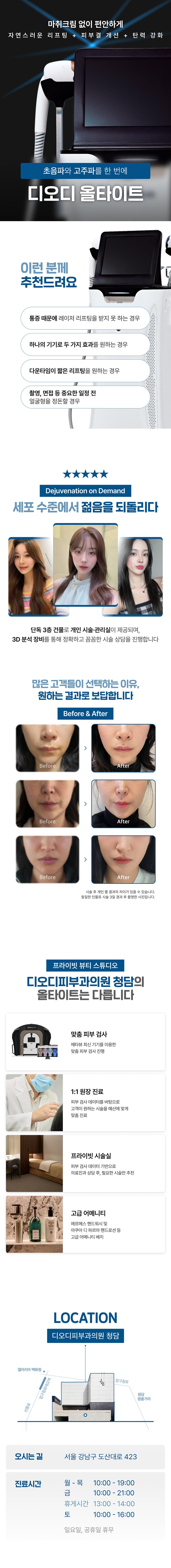디오디 올타이트는 디오디피부과의원 청담점에서 제공하는 빠른 리프팅 효과를 목표로 한 시술 상품입니다.