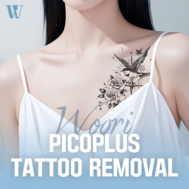 WOORI Pico plus Tattoo Removal