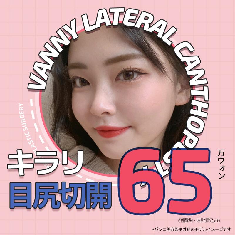 バンニ＿惚れた キラリトゥイム