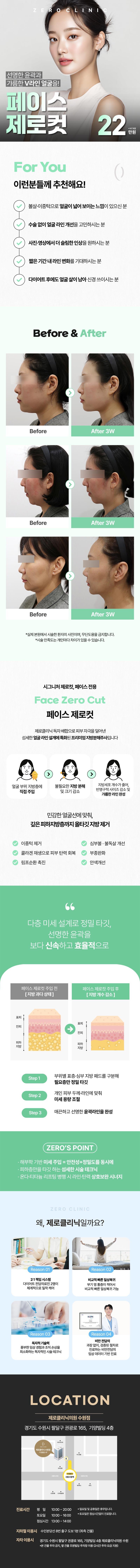 제로의원(수원점)에서 제공하는 얼굴 윤곽 지방분해주사는 22만원으로 제로컷, 사각턱, 보톡스, 침샘 등을 포함한 얼굴 윤곽 개선에 효과적입니다.