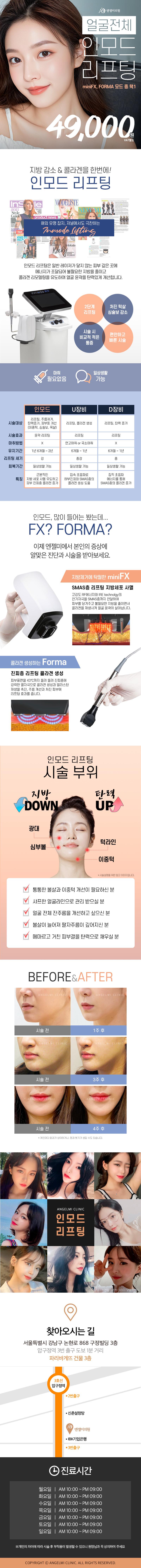 서울 압구정 엔젤미의원의 인모드리프팅 시술로 얼굴지방분해와 피부탄력 개선을 4.9만원에 제공