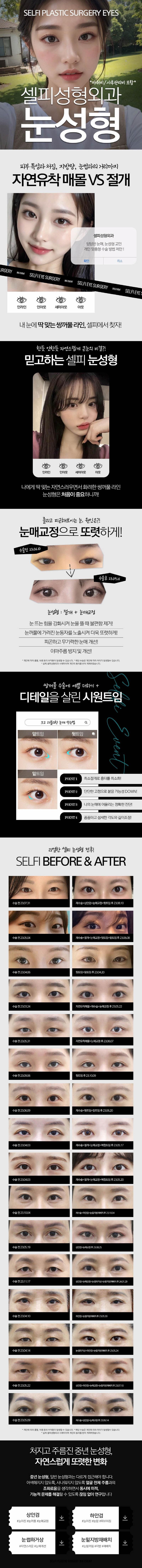 부산 서면에 위치한 셀피성형외과의원에서 제공하는 부산_자연유착 매몰법_셀피 성형 및 시술로, 자연유착 매몰법, 절개법, 트임 등을 포함한 다양한 쌍꺼풀 수술을 제공합니다.