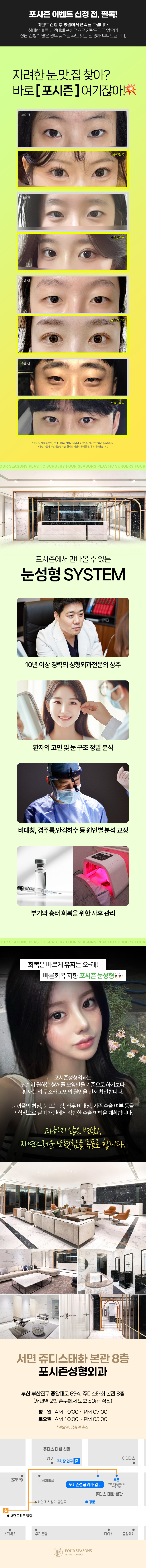 포시즌성형외과의원에서 제공하는 포시즌 눈성형 자연유착 매몰 절개 서비스