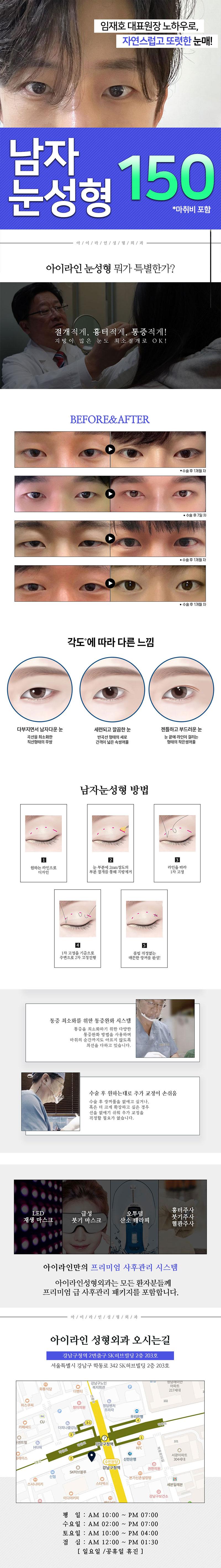 아이라인성형외과의원의 대표원장이 직접 시행하는 자연스러운 눈매를 위한 남자 눈성형 시술입니다.
