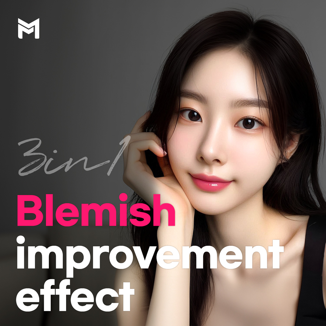 Melasma & Freckle Removal – Blemish Eraser