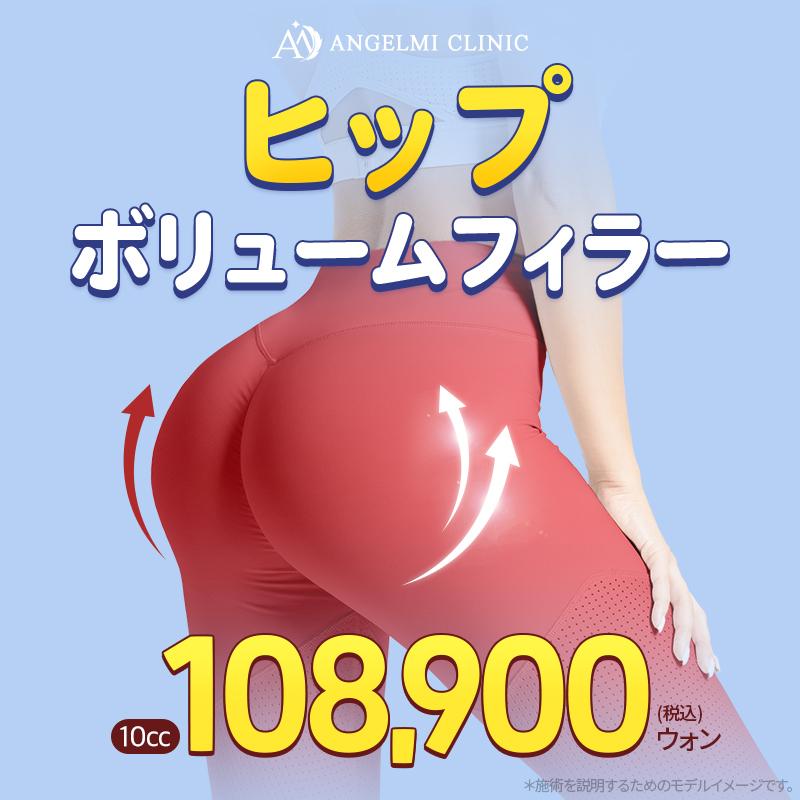 ヒップボリュームフィラー