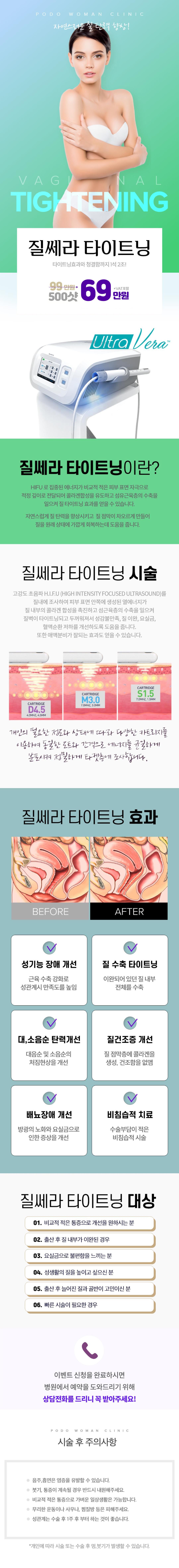 강남역 인근 강남포도여성의원의 여의사가 직접 시술하는 질쎄라 타이트닝 시술 (49만원)
