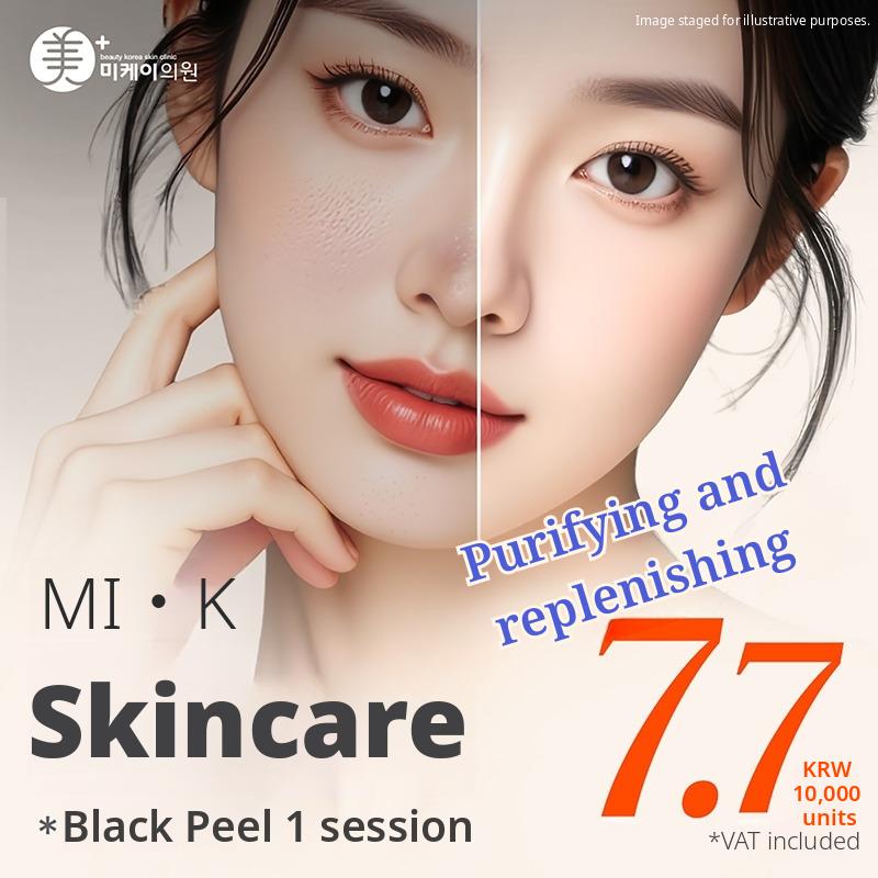 MI·K Black Peel – 1 Session