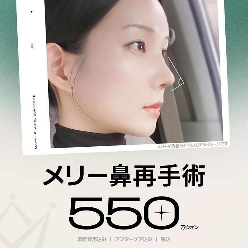 メリー鼻再手術