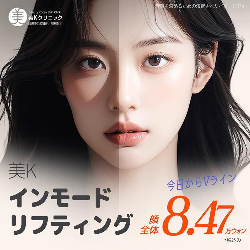 美K インモード リフティング