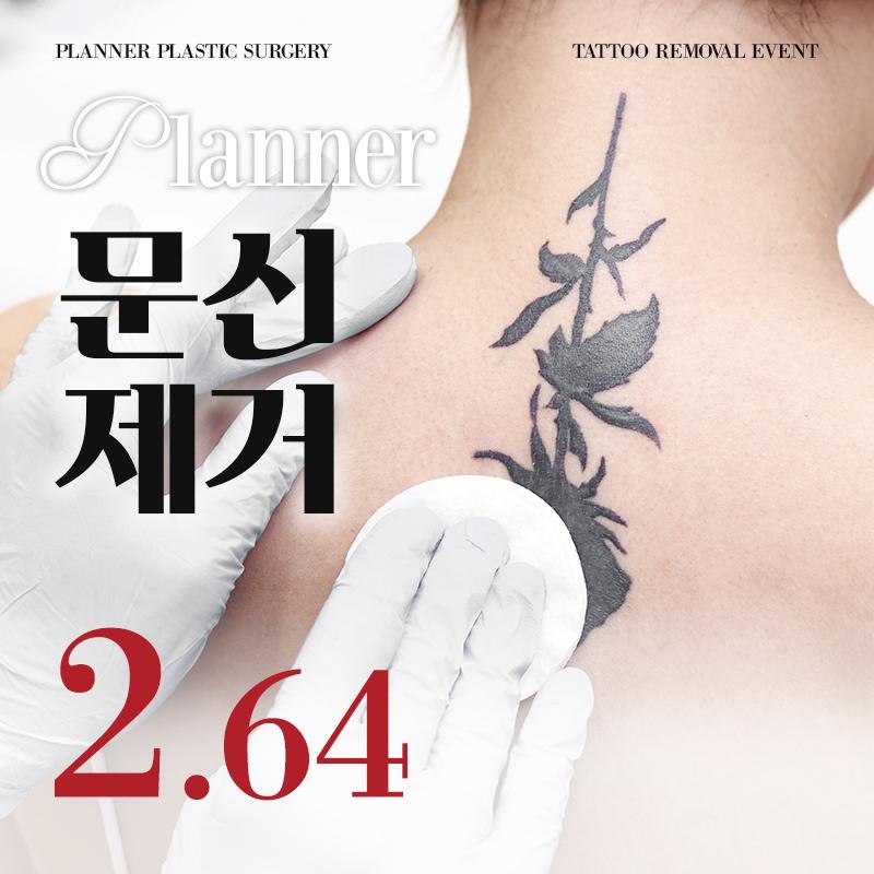 플래너 문신제거
