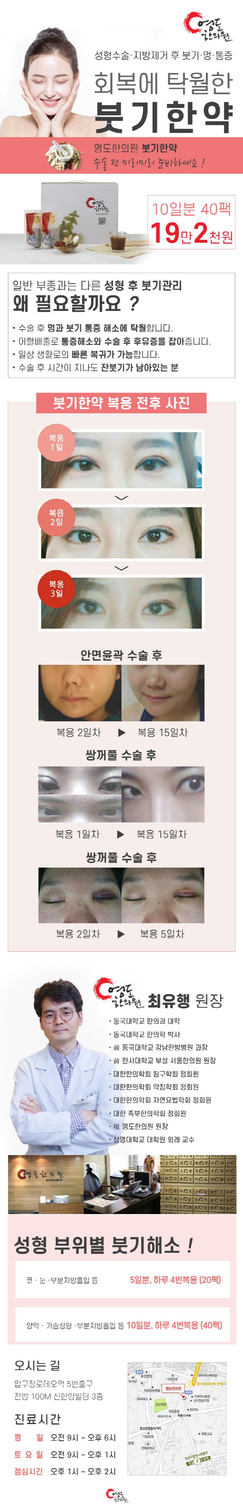 서울 압구정 영도한의원의 성형수술 후 붓기관리 특화 한약 치료 프로그램 (10일분 40팩, 19.2만원)