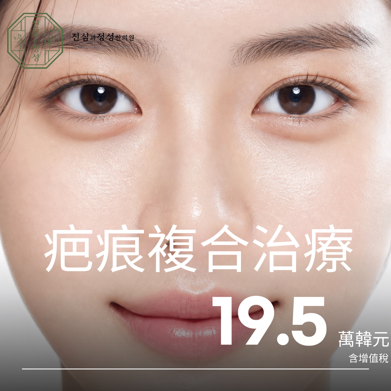 疤痕複合療程