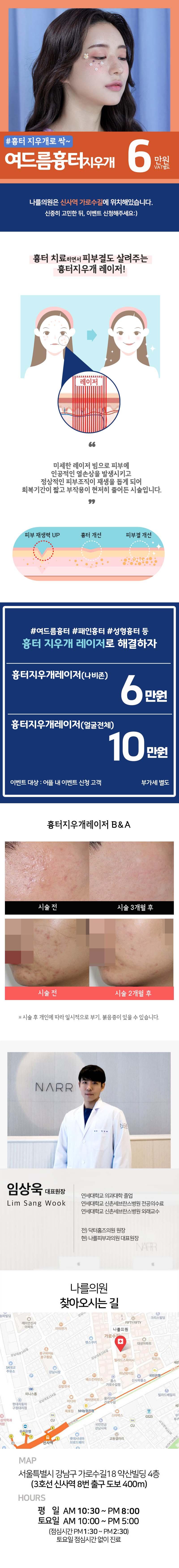 서울 신사동 나르의원의 여드름흉터지우개레이저 시술, 6만원 특가 프로모션