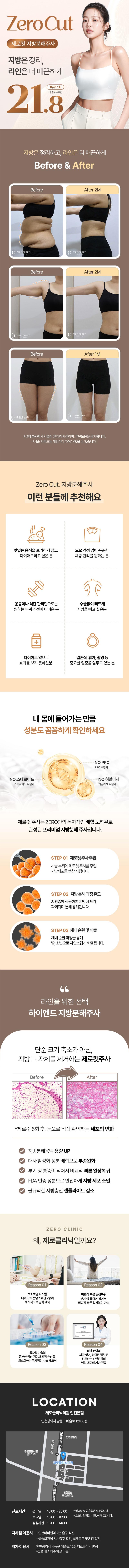 제로의원(인천점)에서 제공하는 제로 바디 지방분해주사 서비스