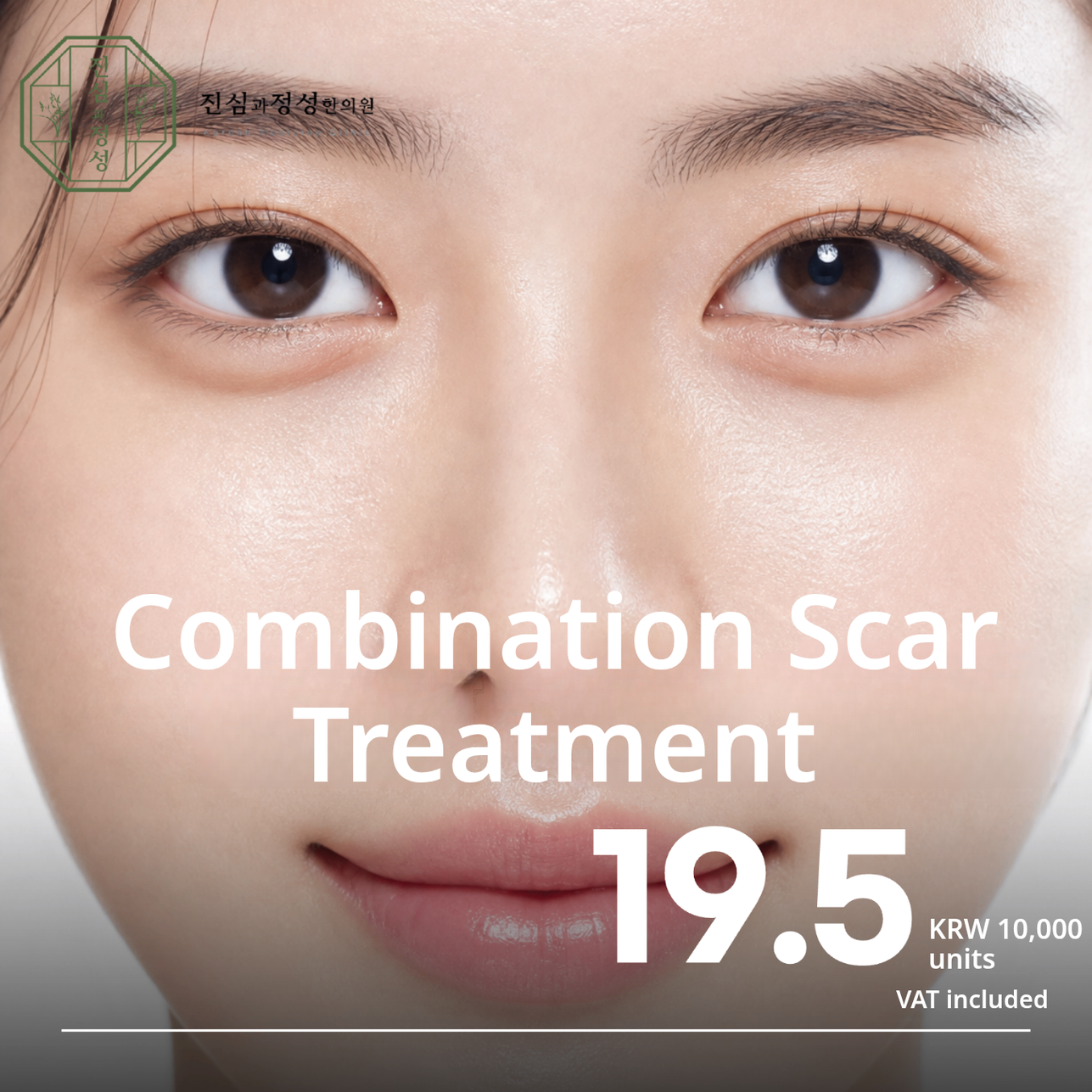 Scar Combination Treatment