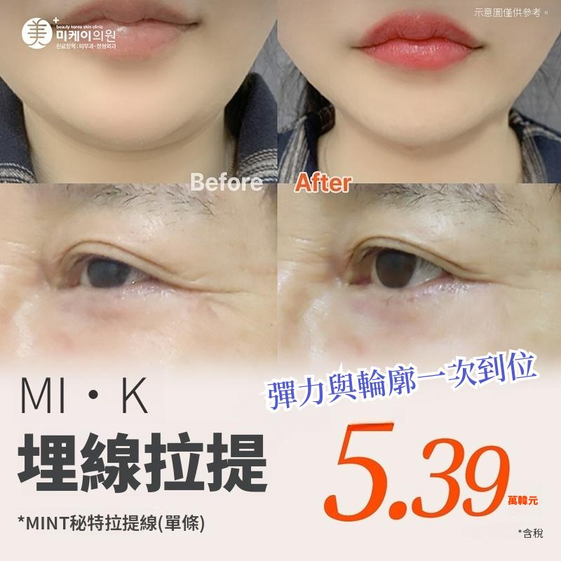 米凱 逆齡拉提_MINT秘特拉提線