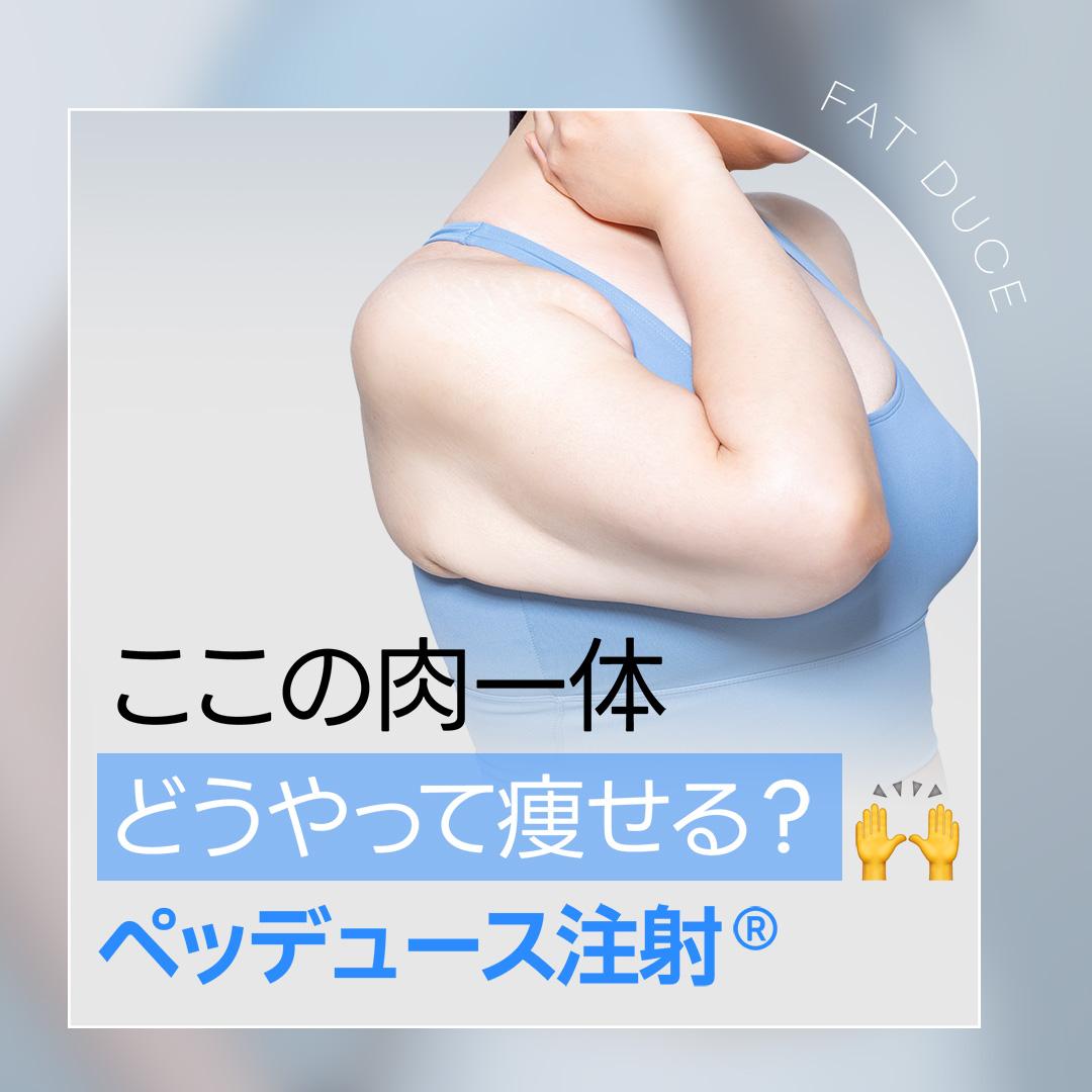 ペッデュース注射_脂肪溶解注射