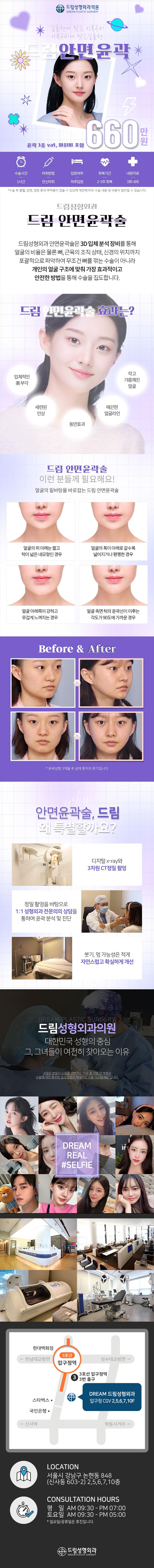 드림성형외과의 안면윤곽 3종 패키지: 660만원으로 사각턱, 광대, 턱끝 윤곽 개선을 통한 자연스러운 얼굴라인 완성