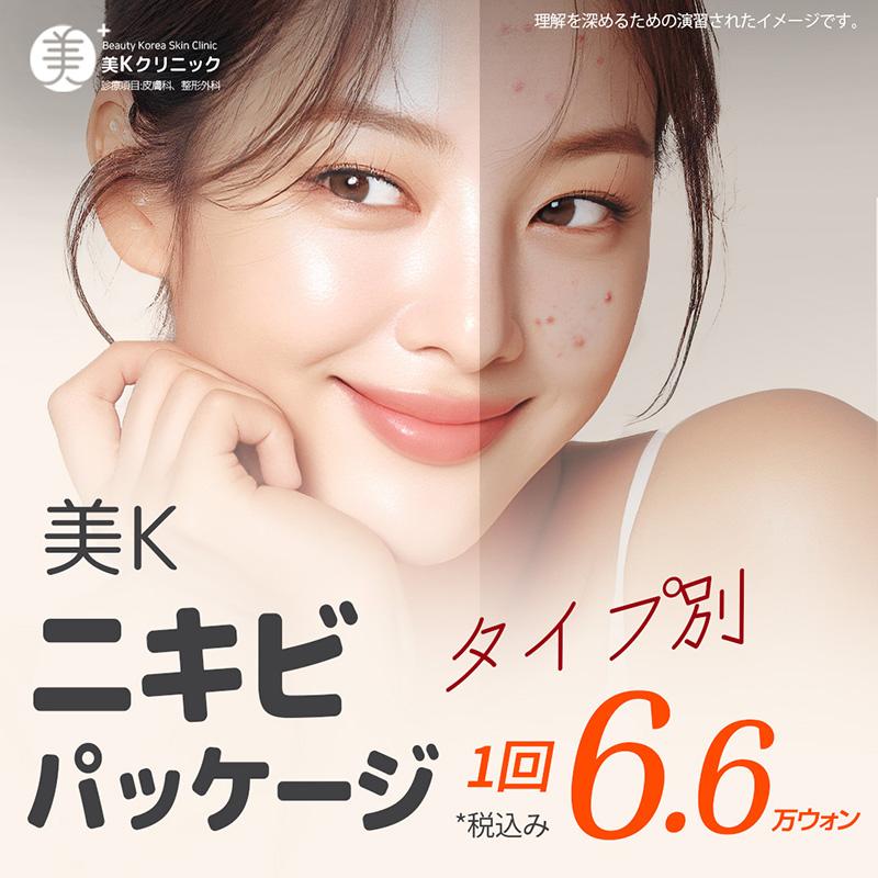美K タイプ別 ニキビ パッケージ イベント_アクアピール, トーニング、Aトーン