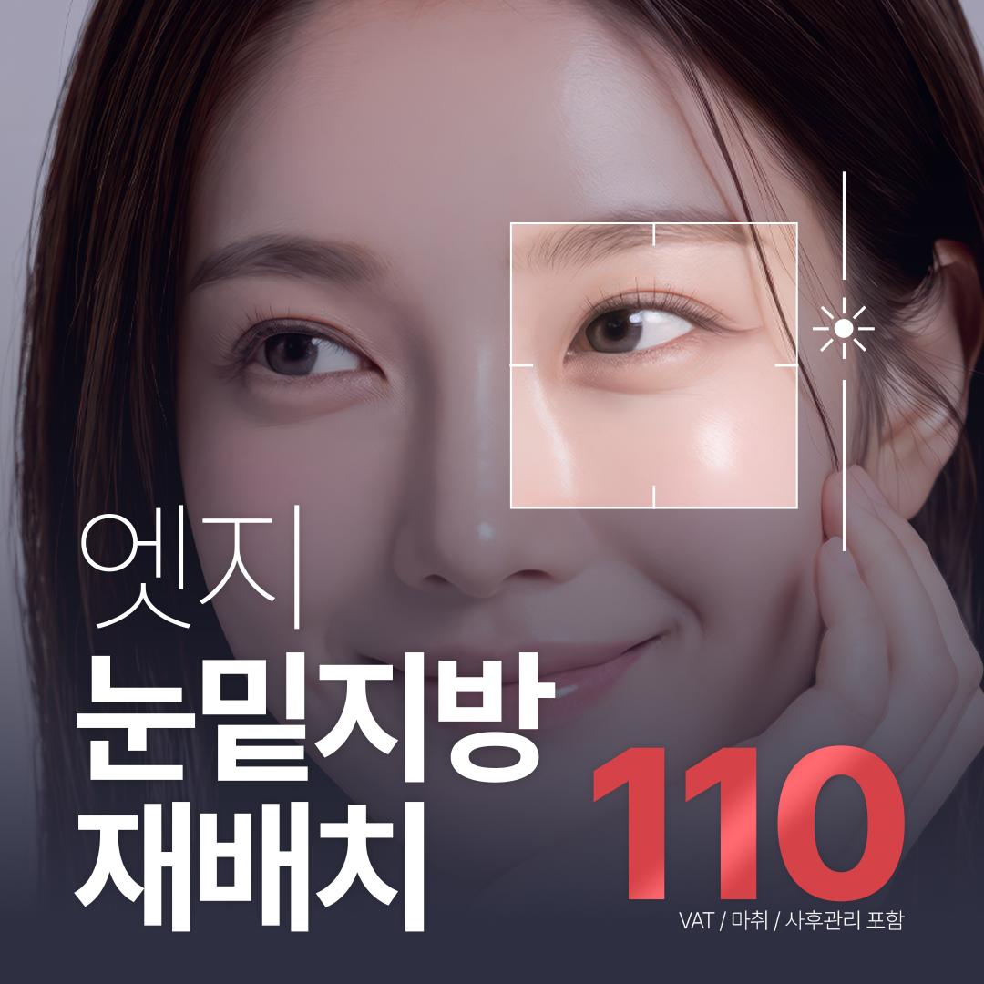 엣지성형외과의원 대구 엣지 눈성형_눈밑지방재배치 이벤트 이미지