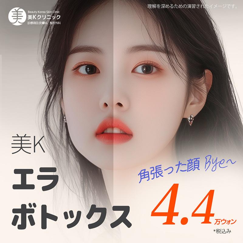 美K エラボトックス