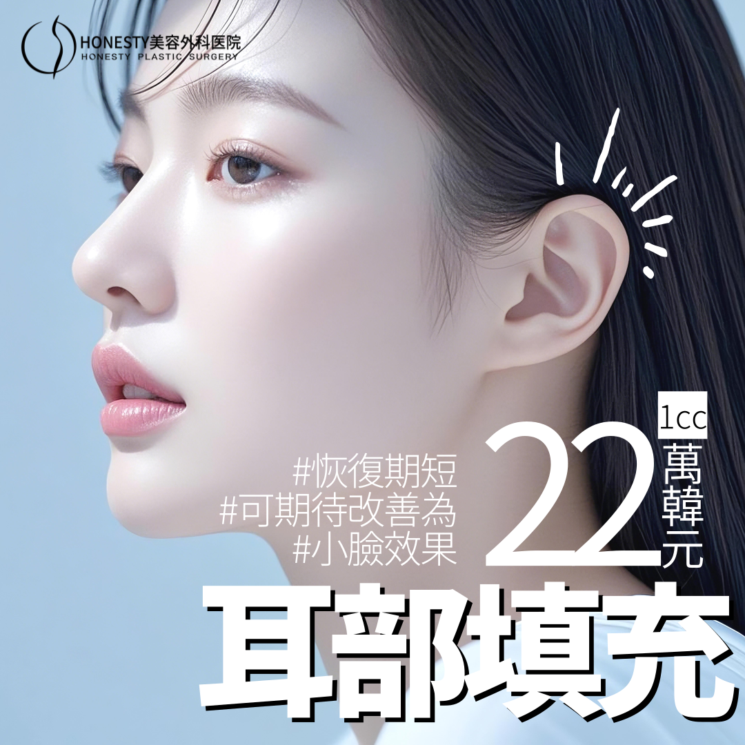 精靈耳玻尿酸