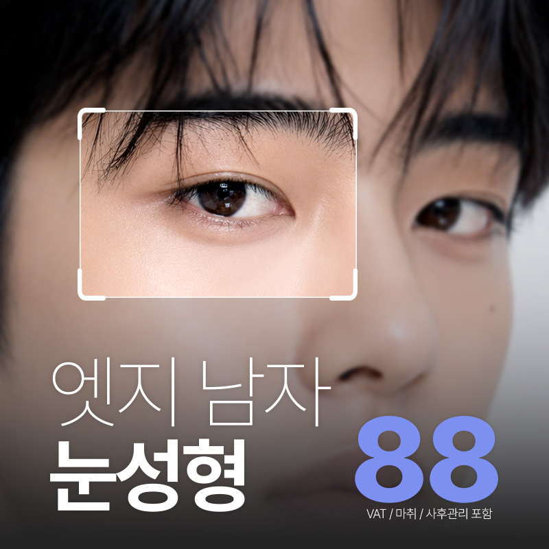 엣지성형외과의원 대구엣지 남자눈성형 이벤트 이미지