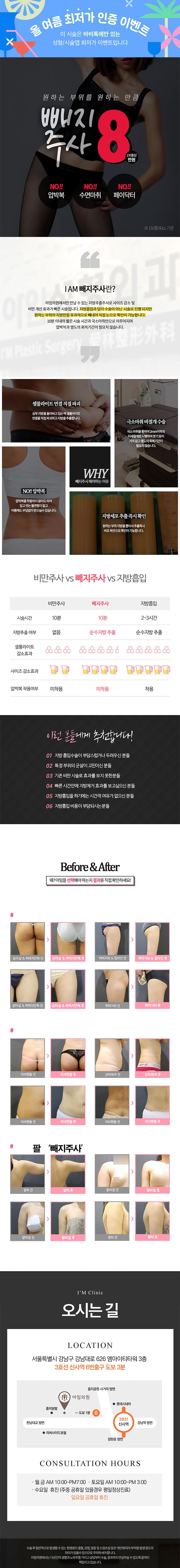 서울 신사동에 위치한 아임의원의 8만원 지방추출 빼지주사 시술 프로모션