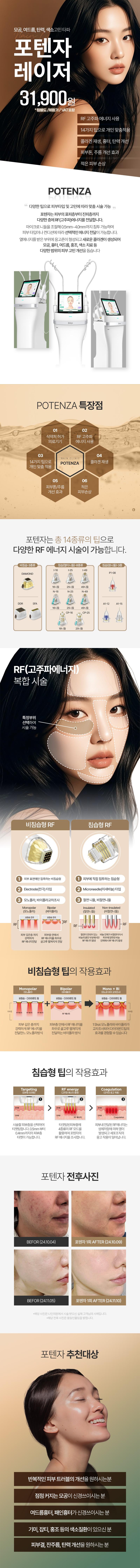 서울 홍대에 위치한 나인의원에서 진행하는 포텐자 모공팁 이벤트로, 모공 개선을 위한 특별한 시술을 제공합니다.