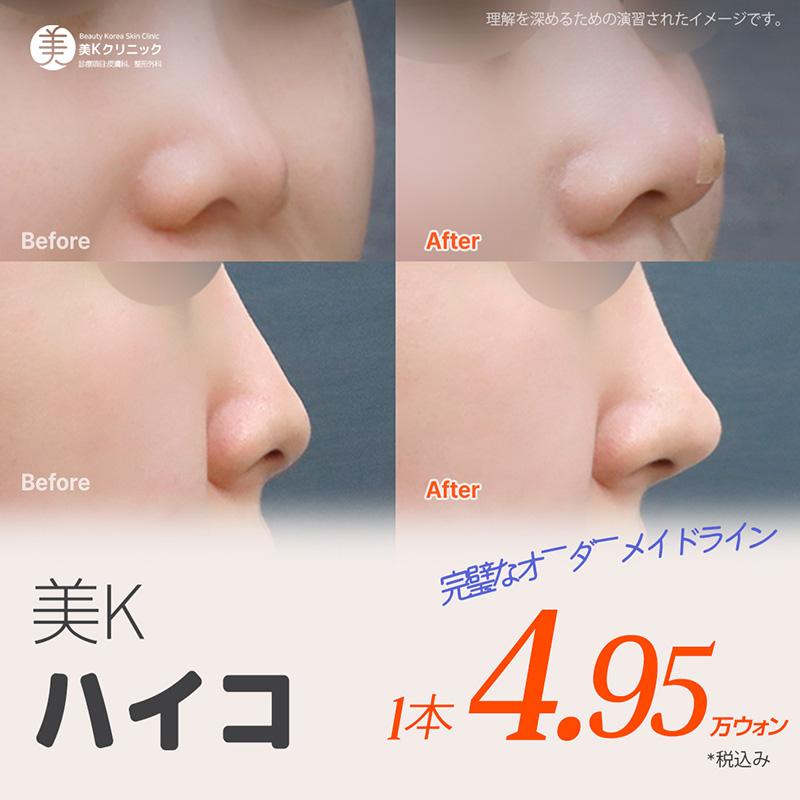 美K 自信ある鼻筋ミント糸_ハイコ